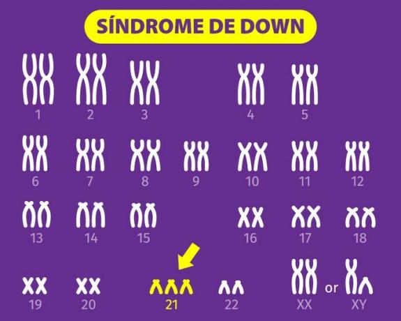 Chromosomal alterations: understand what it is, what they are and examples