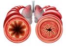 Astma: hva er det, symptomer, diagnose, behandling