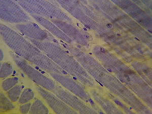 Longitudinal section of striated skeletal muscle tissue and its striations