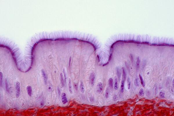 Atkreipkite dėmesį į trachėjos vidinį pamušalą. Paveikslėlyje parodyta, kad tai pseudostratifikuotas blakstieninis epitelis.