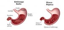 Digestive System, Digestive System: full summary