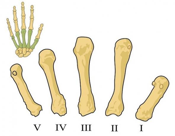 metacarpal bones