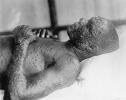 Majmunske boginje: što je to, prijenos, slučajevi