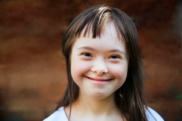 A person with Down syndrome has some observable features, such as an almond-shaped eye.