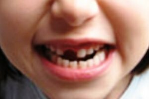 Забота о зубах