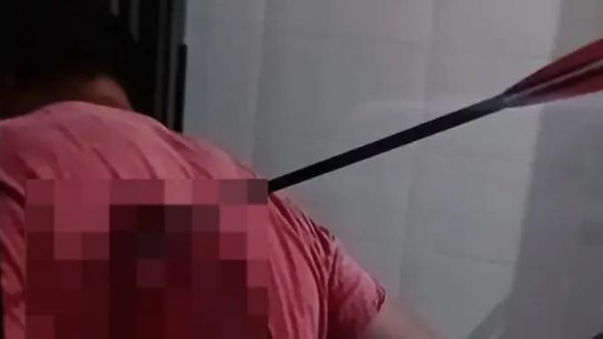 UNBELIEVABLE: in Minas Gerais, a man has an arrow stuck in his back after a fight; look