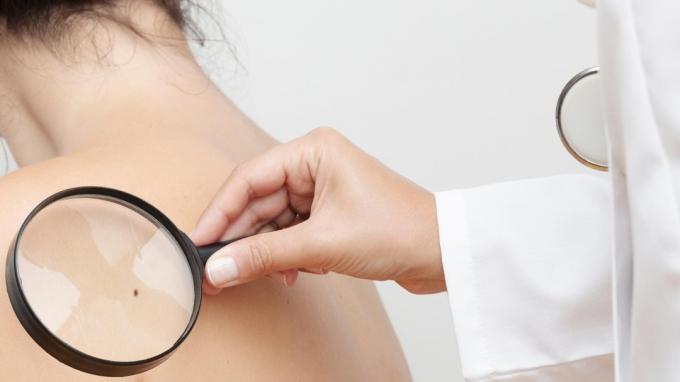 SOYEZ PRÉVU! 7 signes sur la peau qui pourraient indiquer des maladies graves !