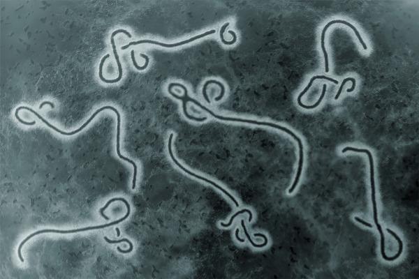 El virus del Ébola es responsable de causar una enfermedad grave y muy letal.