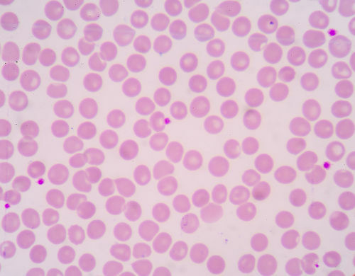 Les globules rouges sont les cellules sanguines les plus nombreuses dans le sang.