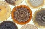 Apa perbedaan antara virus, bakteri, dan jamur?
