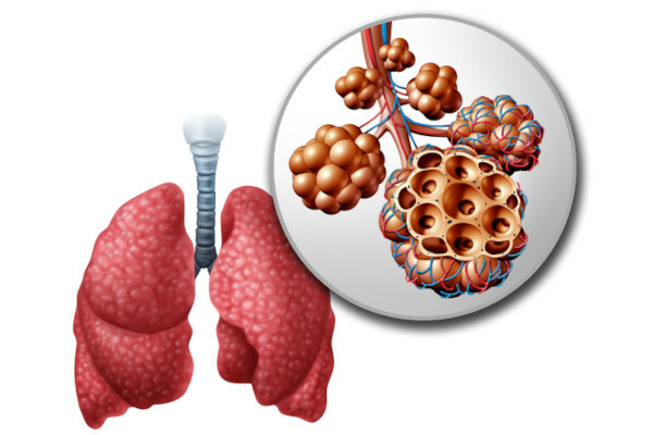 Pulmoner alveoller: ne oldukları, yapı, işlev