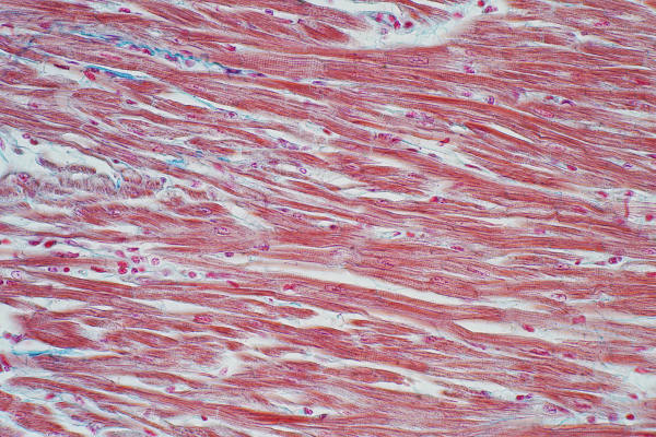 Svalové tkanivo má predĺžené bunky bohaté na bielkoviny so schopnosťou kontrakcie.