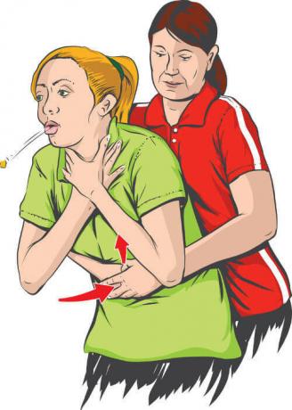 The Heimlich Maneuver can be used in case of choking.