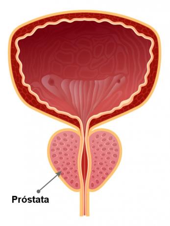 البروستاتا عبارة عن عضو على شكل حبة الجوز يقع أسفل المثانة.