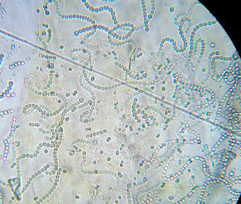 Cyanobakterier observert under mikroskopet