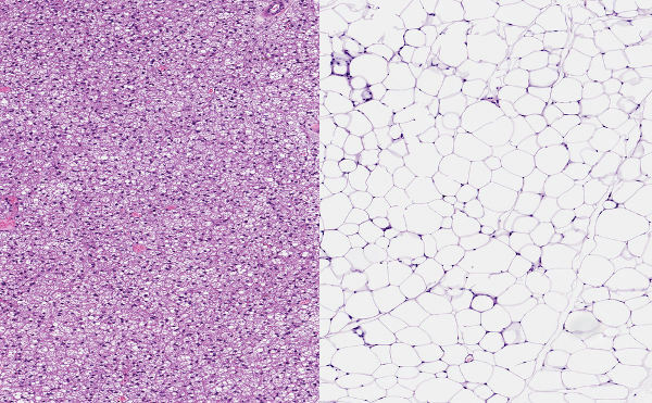  On the left, it is possible to see the multilocular adipose tissue, while on the right, the unilocular adipose tissue is present.