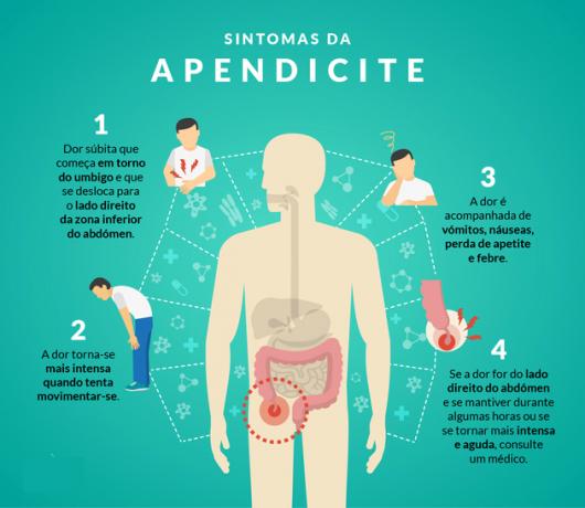 Appendix: what is it, where is it, function and appendicitis