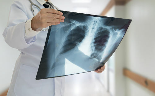 Рентгенографія або рентгенологічне дослідження є прикладом того, як електромагнітне випромінювання може використовуватися в медицині