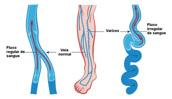 Veins: definition, characteristics and examples