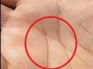 ماذا يعني وجود حرف "X" في يدك؟