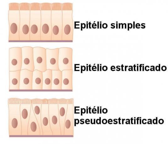Обърнете внимание на разликата между проста, стратифицирана и псевдостратифицирана епителна тъкан.