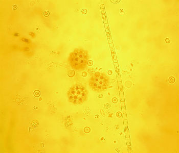 Fytoplankton