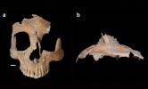 Büyüleyici keşif: arkeologlar binlerce yıl önce ameliyat edilmiş kafatasları buldu