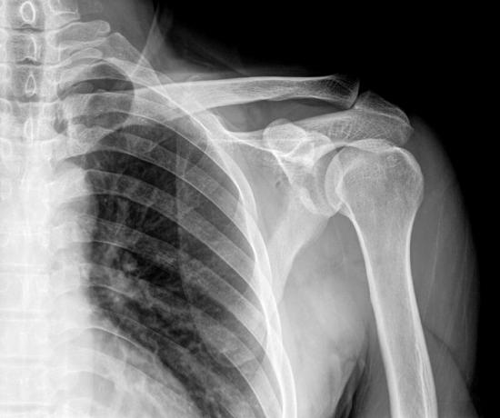 X-rays are absorbed by the bones, so it is possible for us to produce images of the interior of the human body.