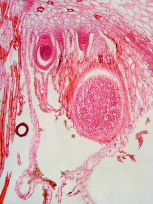 La figura sopra mostra l'archegon di un'erba del fegato con un ingrandimento di 100x