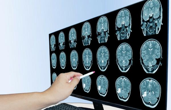  brain tomography
