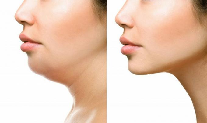 The shape of your chin reveals your personality traits; understand how