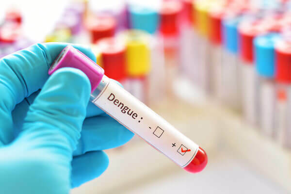Dengue je onemocnění diagnostikované analýzou příznaků a laboratorními testy.