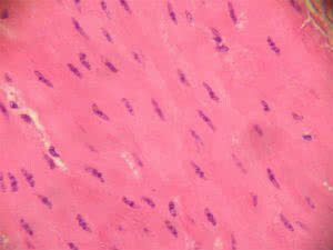 Smooth Muscle Tissue and the absence of striations