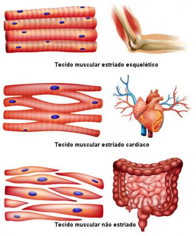 Upoštevajte tri vrste mišičnega tkiva, ki sestavljajo mišice.