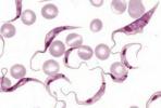 Trypanosoma cruzi: morfologija, gyvenimo ciklas ir chagaso liga