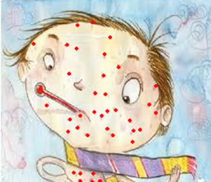 Small sores caused by chickenpox are very itchy
