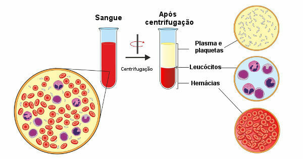 Veren sentrifugoinnin jälkeen on mahdollista havaita sen nestemäisen osan erottuminen verisoluista.