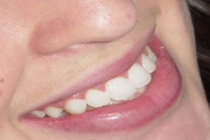 3. října - Světový den zubařů