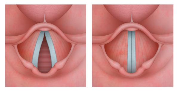 Le corde vocali garantiscono la formazione dei suoni. Quando respiriamo, si aprono.