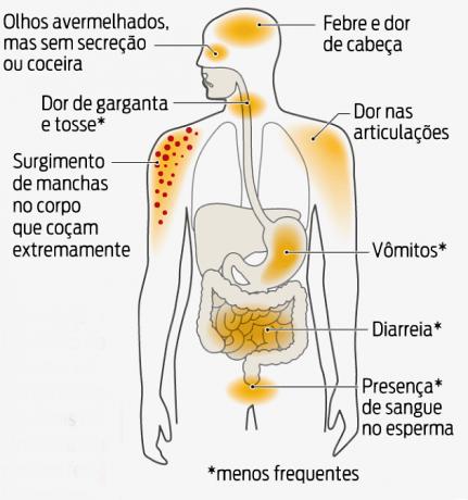 Zika simptomi